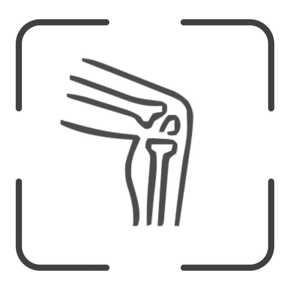 3D Lower-Limb Assessments
